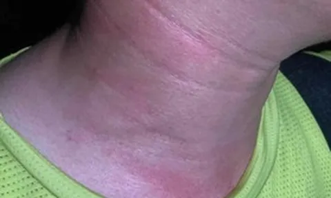 2 phóng viên bị hành hung khi tác nghiệp tại đám cháy ở Hà Nội