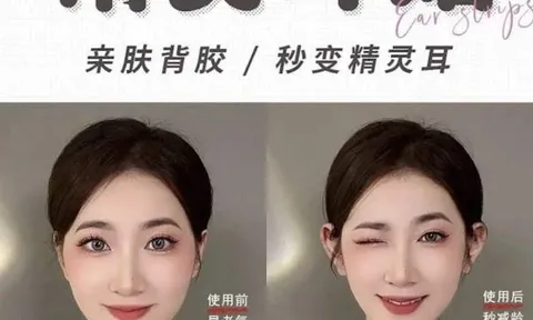 Trào lưu thẩm mỹ ‘tai yêu tinh’ rộ lên ở Trung Quốc