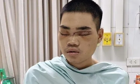 Mã số 5873: Con trai 24 tuổi gặp nạn, mờ mịt tương lai, mẹ đơn thân khẩn cầu sự giúp đỡ