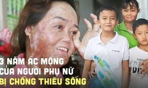 Người phụ nữ bị chồng tưới xăng thiêu sống, bỏng 92%: "3 năm qua giống như một cơn ác mộng, em đau lắm nhưng phải sống vì con"